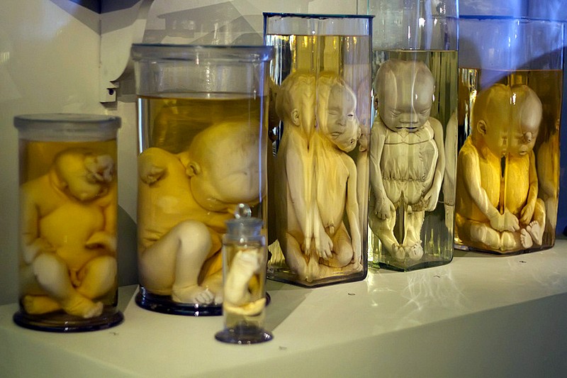 Various oddities kept in spirits in the collection of the Kunstkammer in St Petersburg, Russia